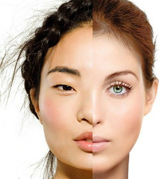 医疗美容已成军备竞赛?亚洲脸型连中国人