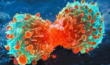 九成癌症患者死于癌细胞扩散科学家找到癌症扩